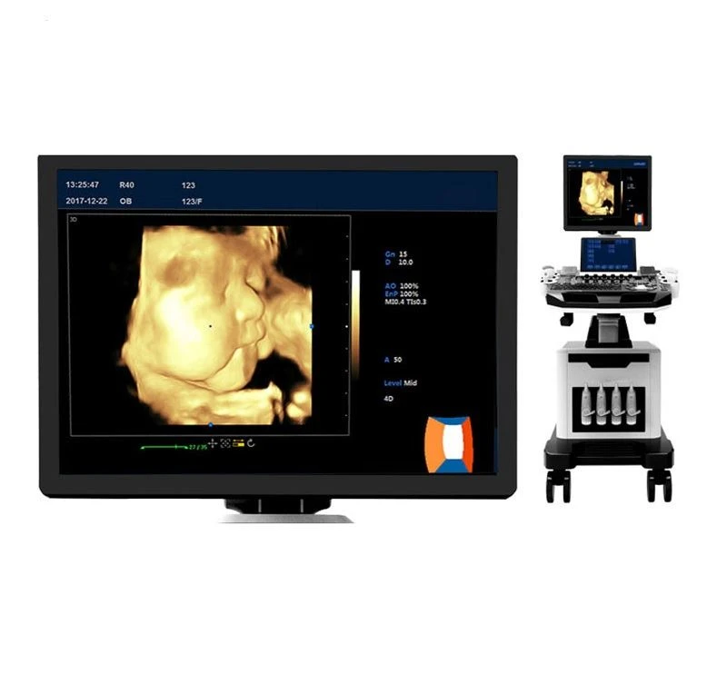 medical ultrasound  machine