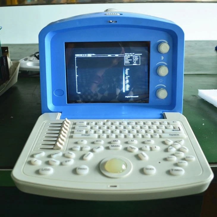 B/W Portable Ultrasound Diagnosis System B/W Portable Ultrasound Diagnosis System
