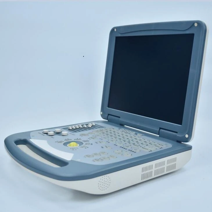 Laptop Ultrasound Scanner