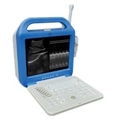 Helppo kuljettaa kannettavaa kannettavaa B / W-kannettavan kannettavan ultraääniskanneria