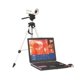 Kannettava videokolpskooppi