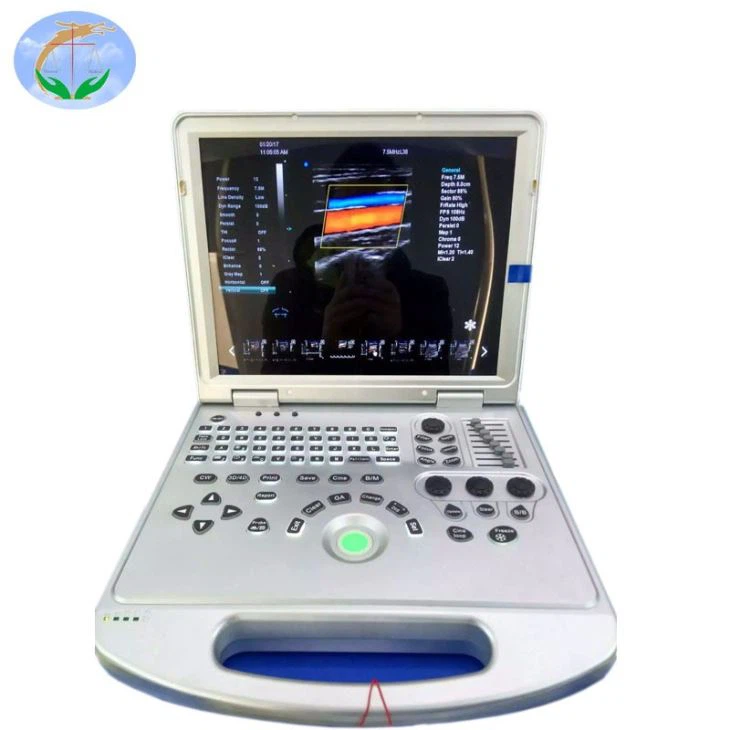 4D Digital Ultrasound Transducer