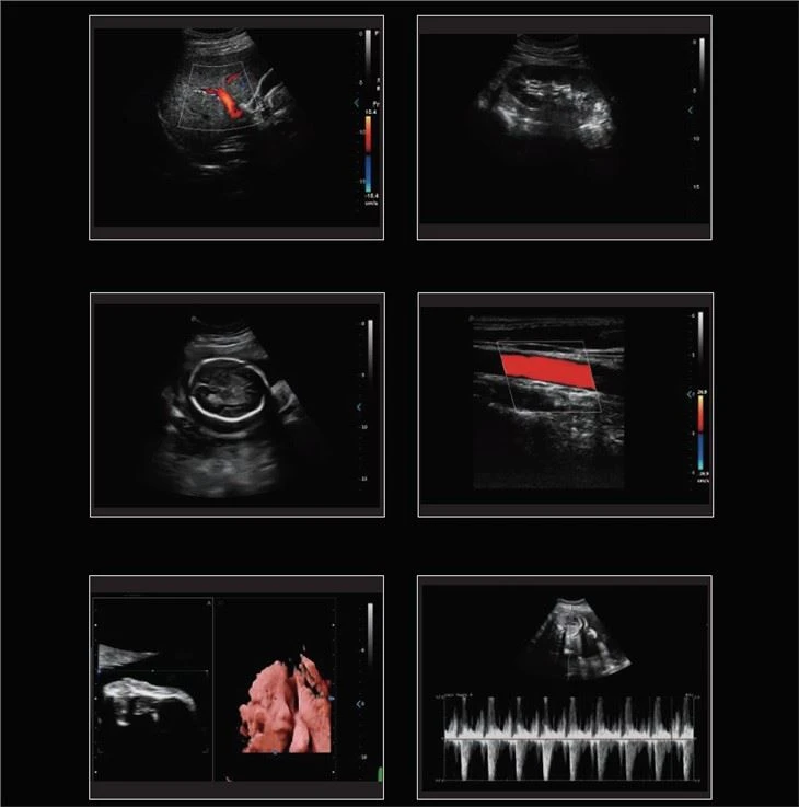 5D Trolley Color Doppler Ultarsound 5D Trolley Color Doppler Ultarsound