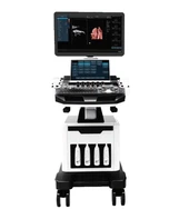 5D-vaunun väri Doppler Ultarsound