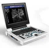 Color Doppler Ultraääni-diagnostiikkajärjestelmä