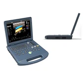 Kannettavan tietokoneen väri Doppler Ultraääni kone