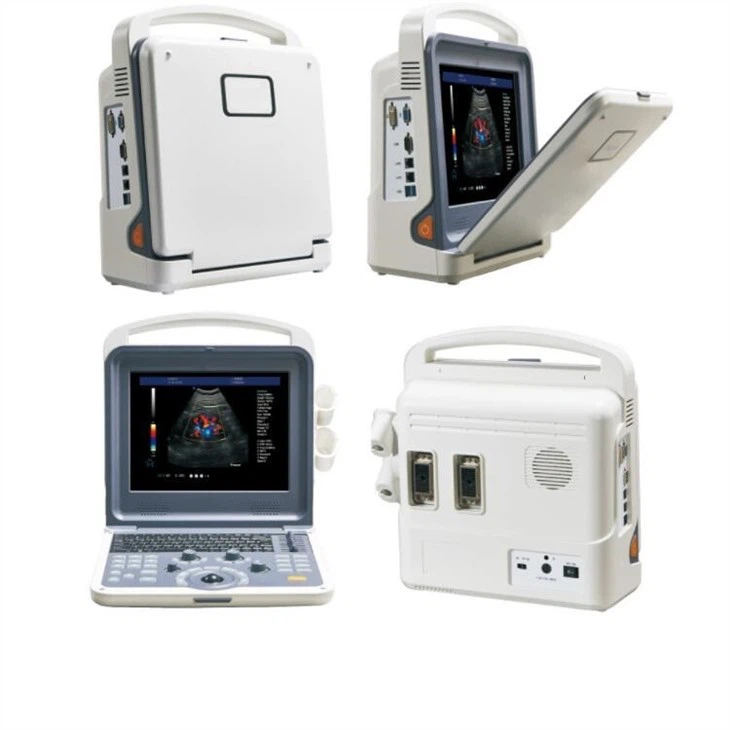 4D Color Doppler Full Digital Color Doppler Ultrasound Diagnostic System